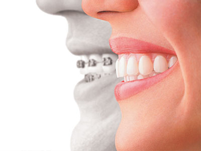 The image features a split-screen graphic with two individuals on either side  the left side shows an adult male smiling, while the right side displays a close-up of a person s teeth, suggesting dental care or oral health promotion.