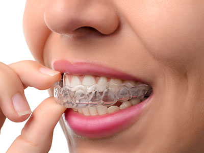 The image shows a person with clear braces, holding a toothbrush and examining their teeth while looking directly at the camera.