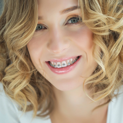 A smiling woman with blonde hair and braces, wearing a white top, against a light background.